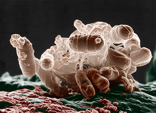 "Colorized low-temperature electron micrograph of a cluster of E. coli bacteria" by Microbe World is licensed under CC BY-NC-SA 2.0.